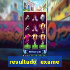 resultado exame eliel figueiredo