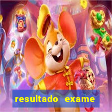 resultado exame eliel figueiredo